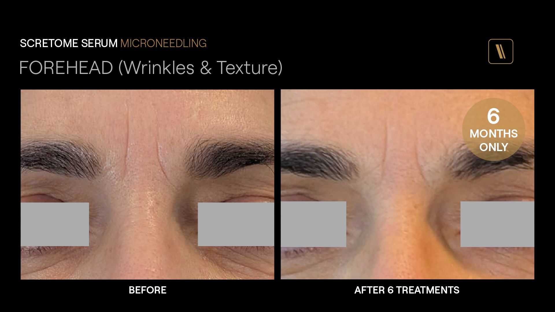 BeforeAfter-DA2