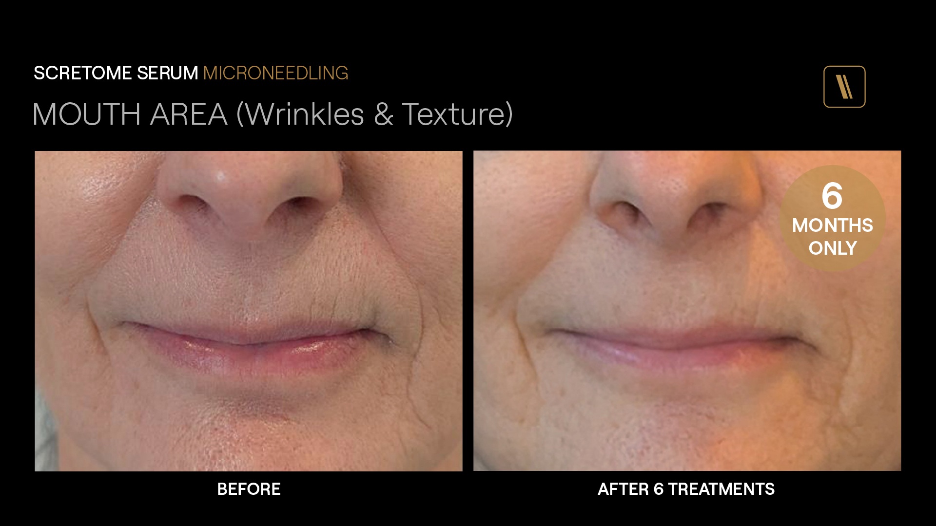 BeforeAfter-DA