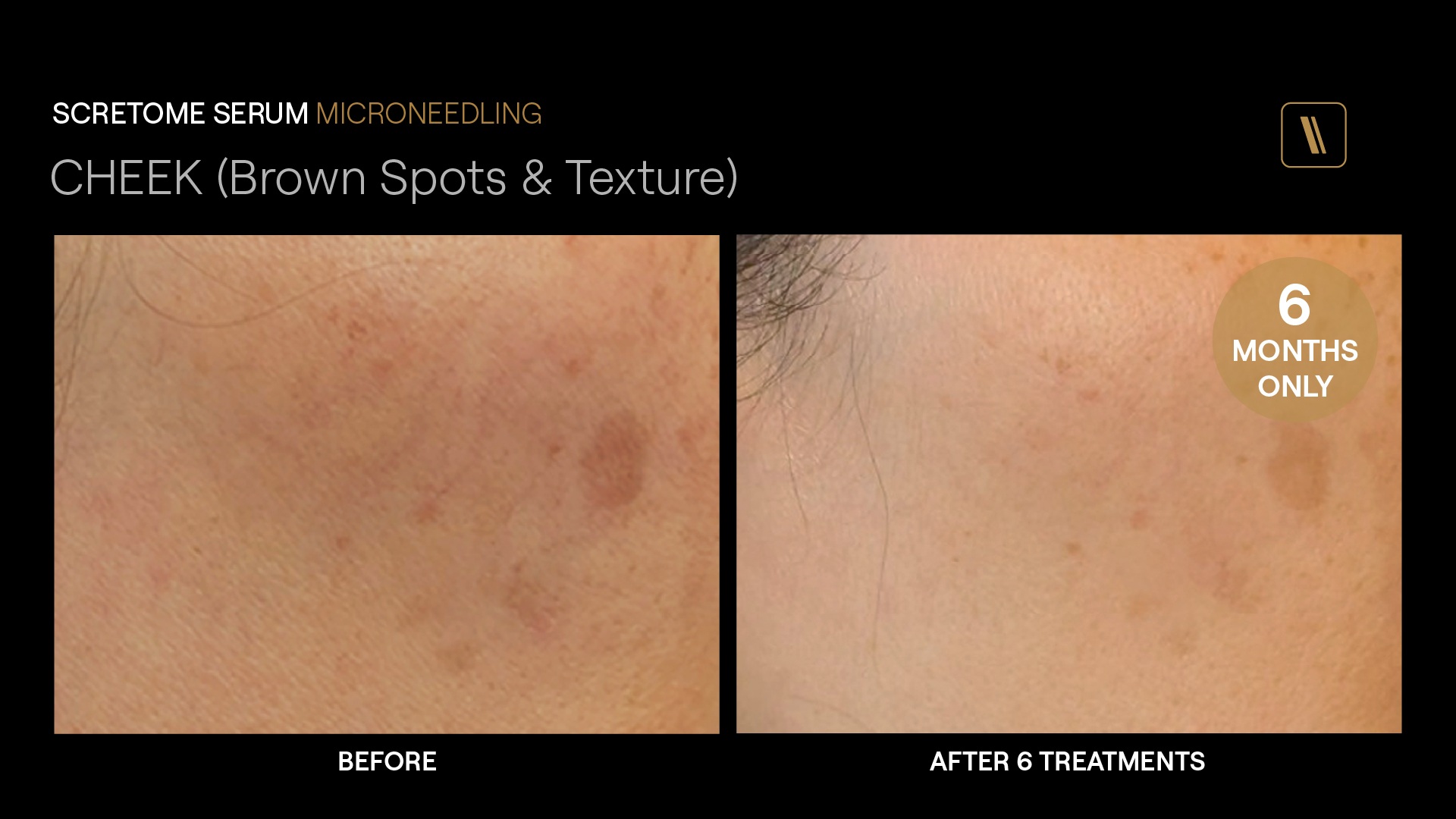 BeforeAfter-EC