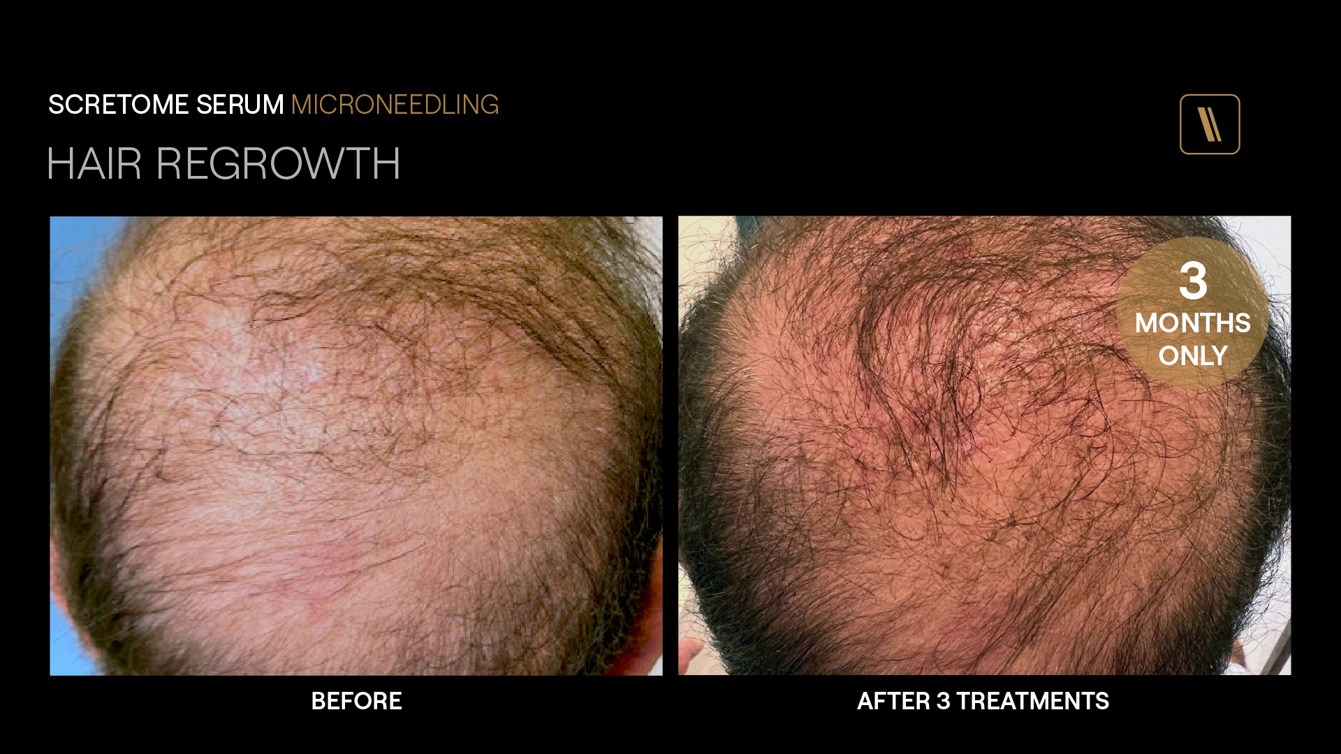 BeforeAfter-PG