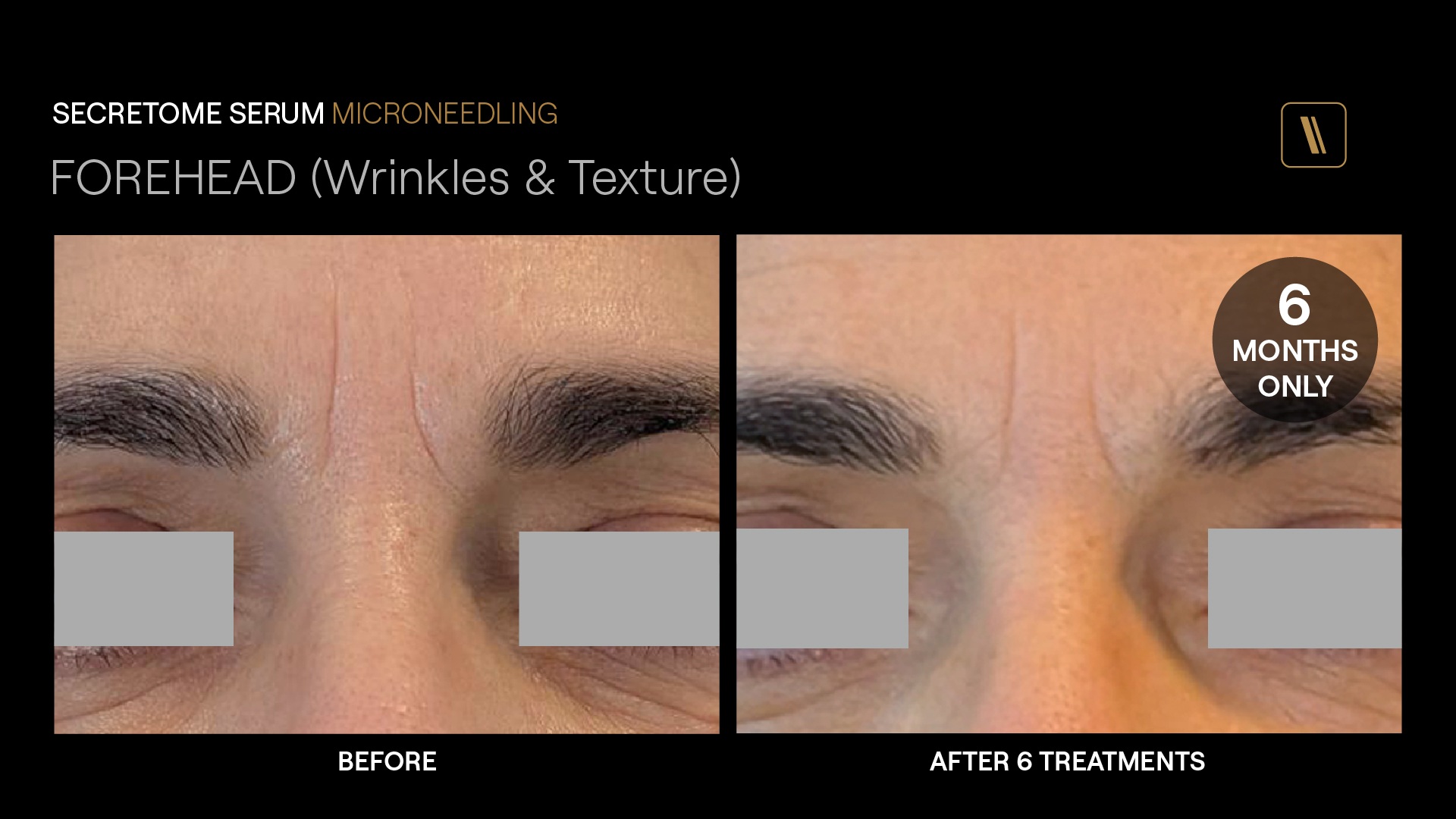 BeforeAfter-DA2
