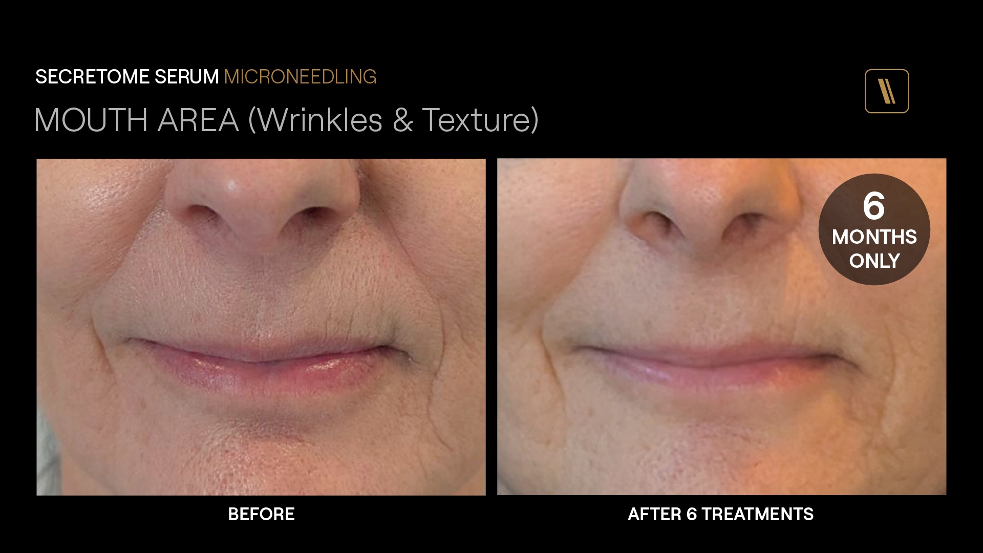 BeforeAfter-DA