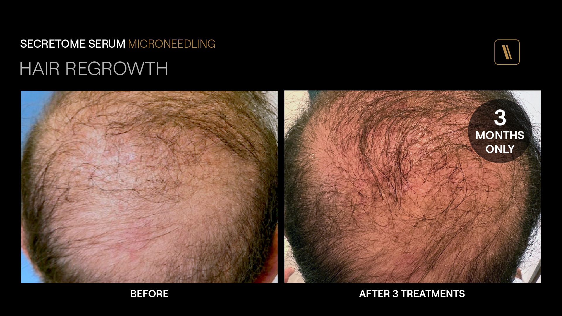 BeforeAfter-PG